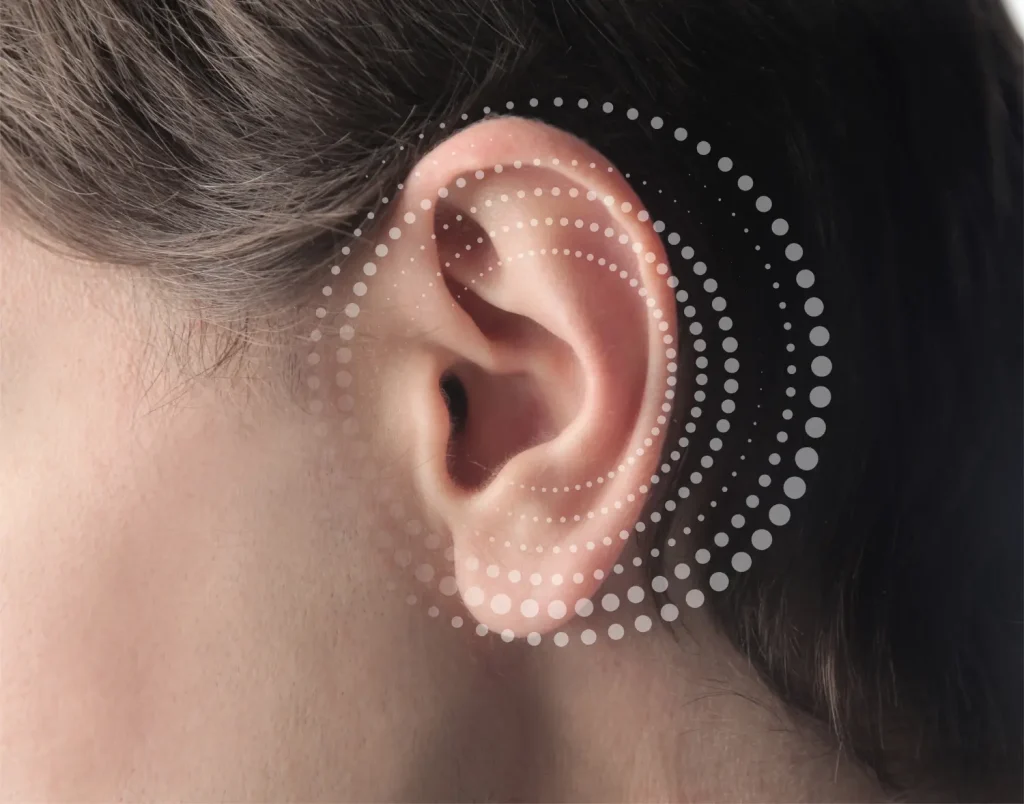 L'auriculothérapie contre l'anxiété consiste à stimuler des points précis de l'oreille liés au système nerveux.